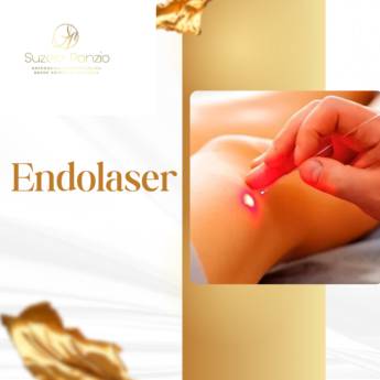 Comprar o produto de Endolaser em Foz do Iguaçu em Clínicas de Estética e Beleza em Foz do Iguaçu, PR por Solutudo