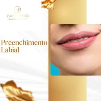 Comprar o produto de Preechimento Labial em Foz do Iguaçu em Beleza, Estética e Bem Estar em Foz do Iguaçu, PR por Solutudo