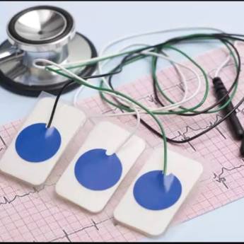 Comprar o produto de Eletrocardiograma: Avaliação da Saúde Cardiovascular em Itatinga - SP em Medicina do Trabalho em Itatinga, SP por Solutudo Comprar o produto de Eletrocardiograma: Avaliação da Saúde Cardiovascular em Itatinga - SP em Medicina do Trabalho em Itatinga, SP por Solutudo