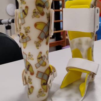 Comprar o produto de Órtese Suropodálica Fixa Infantil Personalizada - Conforto e Correção em Ribeirão Preto/SP em Órteses, próteses e meios auxiliares de locomoção em Ribeirão Preto, SP por Solutudo