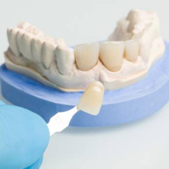 Comprar o produto de Facetas de Resina – Transformação Estética em Lençóis Paulista/SP em Odontologia em Lençóis Paulista, SP por Solutudo