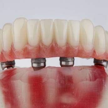 Comprar o produto de Próteses Protocolo – Solução Definitiva para seu Sorriso em Lençóis Paulista/SP em Próteses Dentárias em Lençóis Paulista, SP por Solutudo