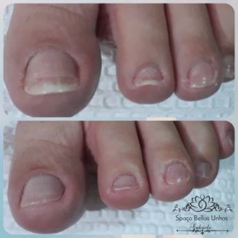 Comprar o produto de Spa dos Pés: Relaxamento e Renovação em São Manuel, SP em Pedicure em São Manuel, SP por Solutudo