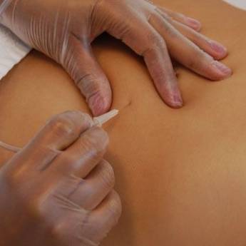 Comprar o produto de Carboxiterapia para Redução de Celulite e Gordura Localizada em Cascavel, PR em Clínicas de Estética e Esteticistas em Cascavel, PR por Solutudo