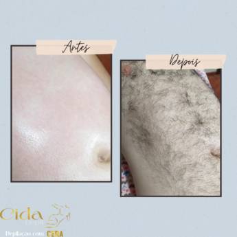 Comprar o produto de Depilação Abdômen  em Depilação em Mineiros, GO por Solutudo