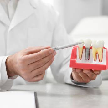 Comprar o produto de Implantes em Implantes em Botucatu, SP por Solutudo Comprar o produto de Implantes em Implantes em Botucatu, SP por Solutudo