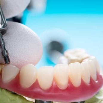 Comprar o produto de Transforme Seu Sorriso – Ortodontia com Segurança em Lençóis Paulista em Odontologia em Lençóis Paulista, SP por Solutudo