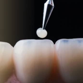 Comprar o produto de Restauração  em Odontologia em Botucatu, SP por Solutudo Comprar o produto de Restauração  em Odontologia em Botucatu, SP por Solutudo