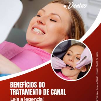 Comprar o produto de Livre-se da Dor com Tratamento de Canal em Avaré – Ponto Dentes em Odontologia em Avaré, SP por Solutudo