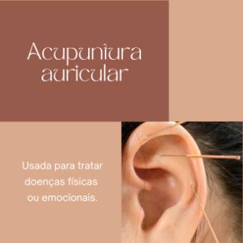 Comprar o produto de Acupuntura Auricular em Americana – Terapia natural para ansiedade, dores e compulsões em Nossos Serviços em Americana, SP por Solutudo