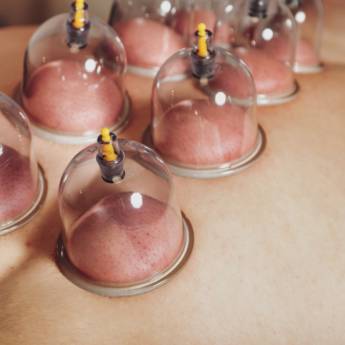 Comprar o produto de Ventosaterapia  em Massagem em Jundiaí, SP por Solutudo