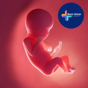 Comprar o produto de Exame de Sexagem Fetal  em Exames em Mineiros, GO por Solutudo