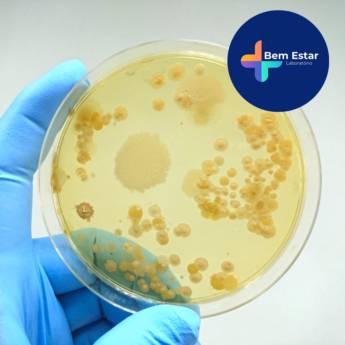 Comprar o produto de Exames de Microbiologia  em Exames em Mineiros, GO por Solutudo