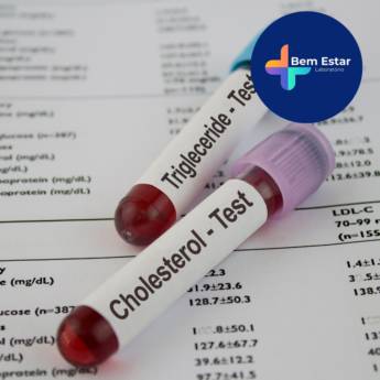 Comprar o produto de Exames de Bioquímica  em Exames em Mineiros, GO por Solutudo