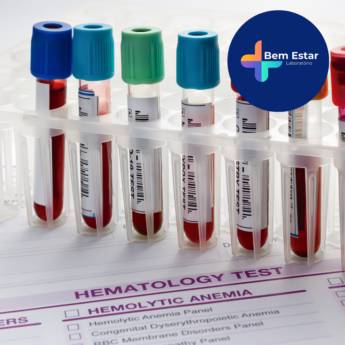 Comprar o produto de Exames de Hematologia  em Exames em Mineiros, GO por Solutudo