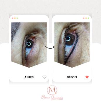 Comprar o produto de Delineado dos Olhos com Micropigmentação em Goiatuba em Clínicas de Estética e Esteticistas em Goiatuba, GO por Solutudo Comprar o produto de Delineado dos Olhos com Micropigmentação em Goiatuba em Clínicas de Estética e Esteticistas em Goiatuba, GO por Solutudo