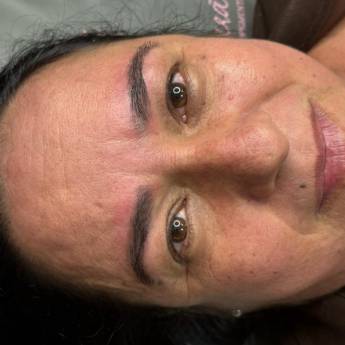 Comprar o produto de Remoção de Sobrancelhas Tatuadas e Escuras a Laser em Goiatuba em Clínicas de Estética e Esteticistas em Goiatuba, GO por Solutudo Comprar o produto de Remoção de Sobrancelhas Tatuadas e Escuras a Laser em Goiatuba em Clínicas de Estética e Esteticistas em Goiatuba, GO por Solutudo