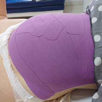 Comprar o produto de Taping Pós-Parto em Avaré – Recuperação Segura com Técnica Não Invasiva em Consultoria em Saúde em Avaré, SP por Solutudo