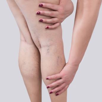 Comprar o produto de Secagem de Microvasos em Beleza, Estética e Bem Estar em Bauru, SP por Solutudo