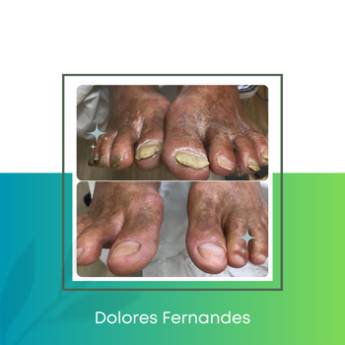 Comprar o produto de Tratamento do Pé Diabético  em Podologia pela empresa Dolores Fernandes - Podóloga  em Americana, SP por Solutudo