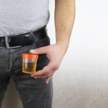 Comprar o produto de Exame de Urina em Santarém/PA – Diagnóstico Completo com o Laboratório Primavera em Exames  em Monte Alegre, PA por Solutudo