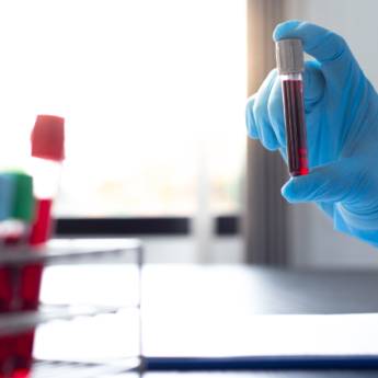 Comprar o produto de Teste de Gravidez em Santarém/PA – Confirmação Rápida no Laboratório Primavera em Exames  em Monte Alegre, PA por Solutudo