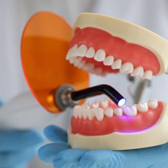 Comprar o produto de Restaurações em Resina: Estética e Funcionalidade em Uberlândia/MG  em Odontologia em Patrocínio, MG por Solutudo