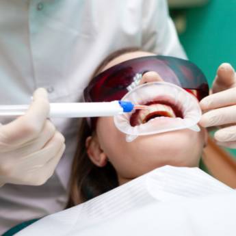 Comprar o produto de Clareamento Dental: Sorriso Brilhante e Saudável em Uberlândia/MG em Odontologia pela empresa Prado e Neves  em Patrocínio, MG por Solutudo