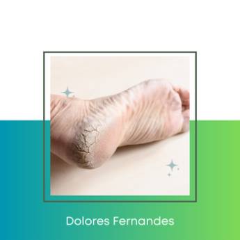 Comprar o produto de Tratamento em Pés Rachados  em Podologia pela empresa Dolores Fernandes - Podóloga  em Americana, SP por Solutudo