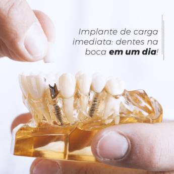 Comprar o produto de IMPLANTE DENTÁRIO  em Odontologia em Americana, SP por Solutudo