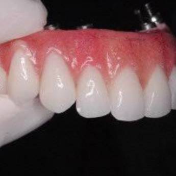 Comprar o produto de Protese sobre implante - PROTOCOLOGO em A Classificar em Bauru, SP por Solutudo