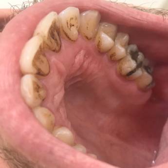 Comprar o produto de Raspagem Periodontal em Odontologia em Bauru, SP por Solutudo