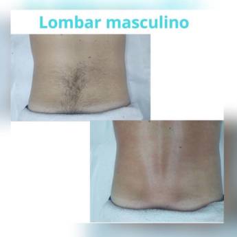 Comprar o produto de Depilação Lombar Masculino  em Depilação em Americana, SP por Solutudo