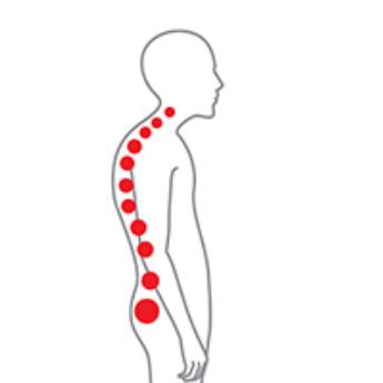 Comprar o produto de Plano Reeducação Postural em Outros Serviços em Bauru, SP por Solutudo