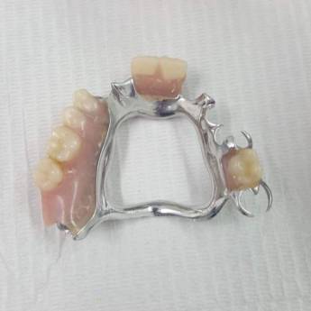 Comprar o produto de Prótese Parcial Removível  em A Classificar em Bauru, SP por Solutudo