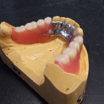 Comprar o produto de Prótese Parcial Removível  em A Classificar em Bauru, SP por Solutudo