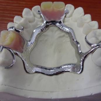 Comprar o produto de Prótese Parcial Removível  em A Classificar em Bauru, SP por Solutudo