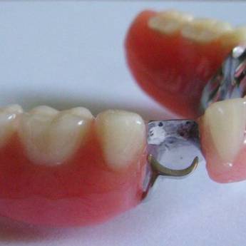 Comprar o produto de Prótese Parcial Removível  em A Classificar em Bauru, SP por Solutudo