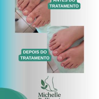 Comprar o produto de Podologia em Santa Helena de Goiás – Saúde e Conforto para Seus Pés em Podologia em Santa Helena de Goiás, GO por Solutudo