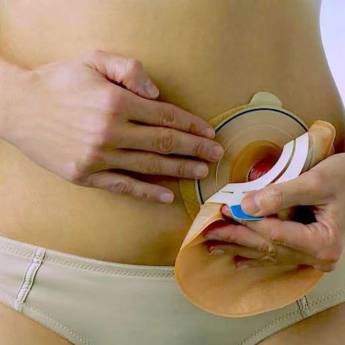 Comprar o produto de Cuidados com Bolsa de Colostomia em Bauru em Enfermeiros e Cuidadores em Bauru, SP por Solutudo