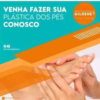 Comprar o produto de Plástica dos Pés  em Salões de Beleza em Arcoverde, PE por Solutudo