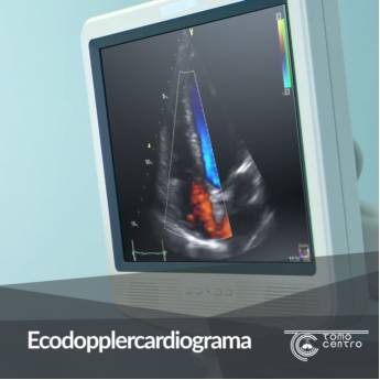 Comprar o produto de Ecodopplercardiograma em Radiologia e Diagnóstico por Imagem em Botucatu, SP por Solutudo