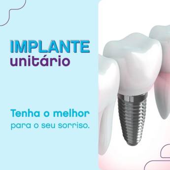 Comprar o produto de Implante Unitário  em Odontologia em Americana, SP por Solutudo