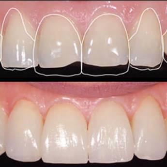 Comprar o produto de Restauração Estética em Outros em Bauru, SP por Solutudo