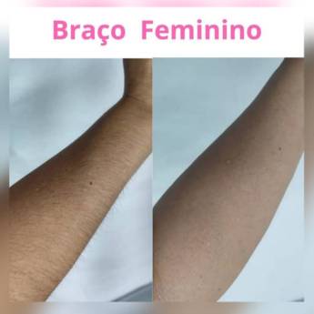 Comprar o produto de Depilação Braço Feminino  em Depilação em Americana, SP por Solutudo