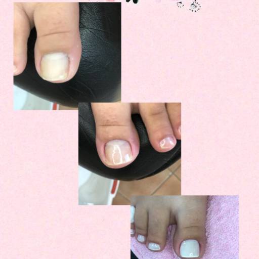 Unha do pé com esmaltaçao e francesinha 