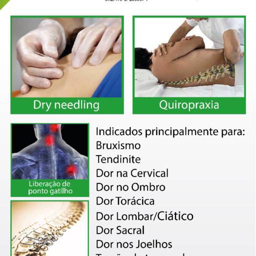 Comprar o produto de Dry needling em Outros pela empresa Ortensi's Fisioterapia e Pilates em Bauru, SP por Solutudo