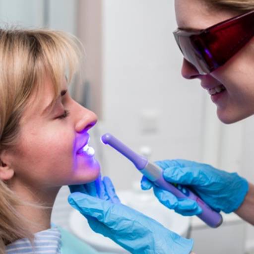 Clareamento Dental a Laser  em Americana, SP por Dra. Ana Barros - Odontologia e Estética 