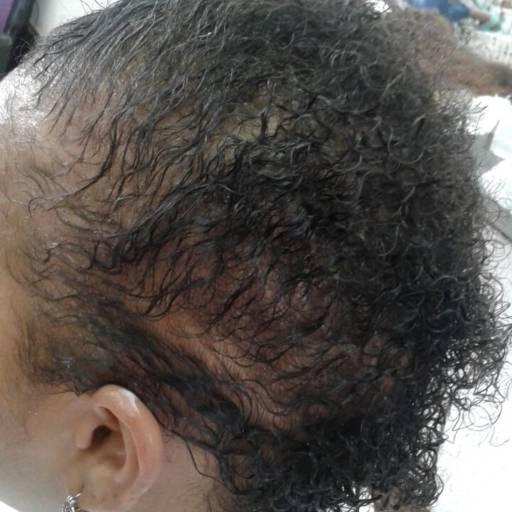 alongamentos de cabelo por Raça e Raiz