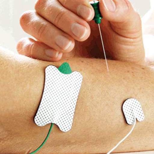 Eletroneuromiografia